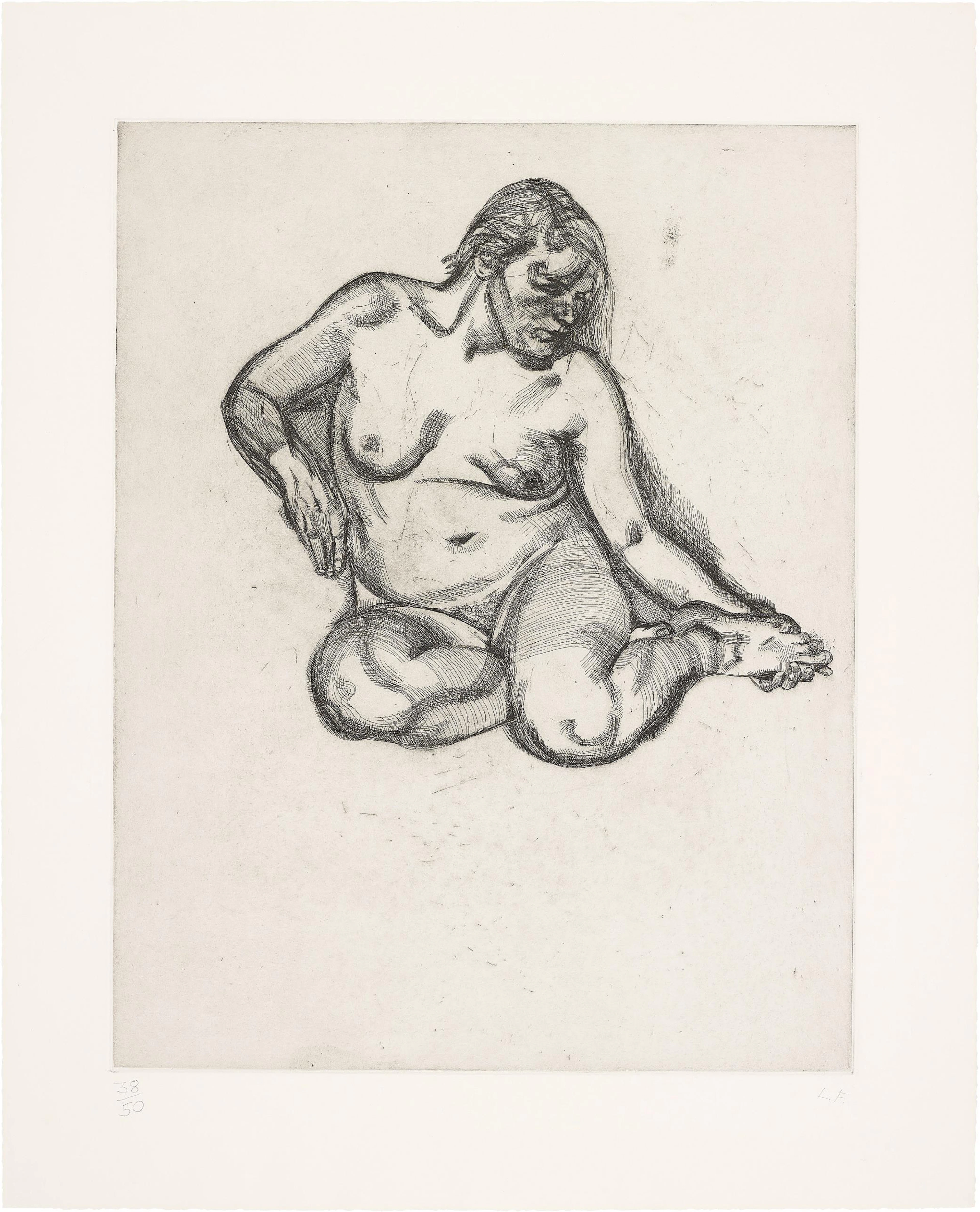 Girl Holding Her Foot, 1985 – Lucian Freud