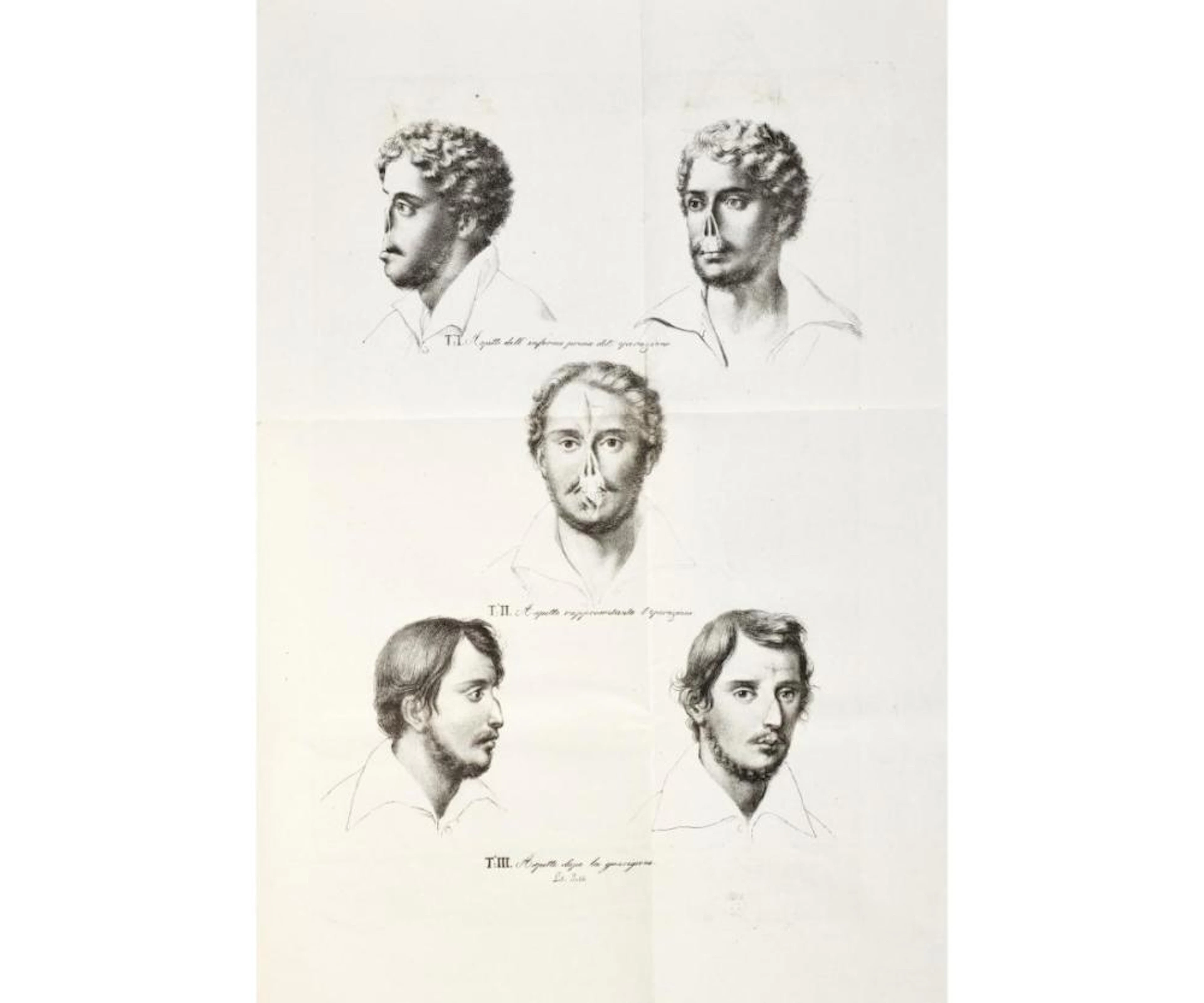 Sabattini