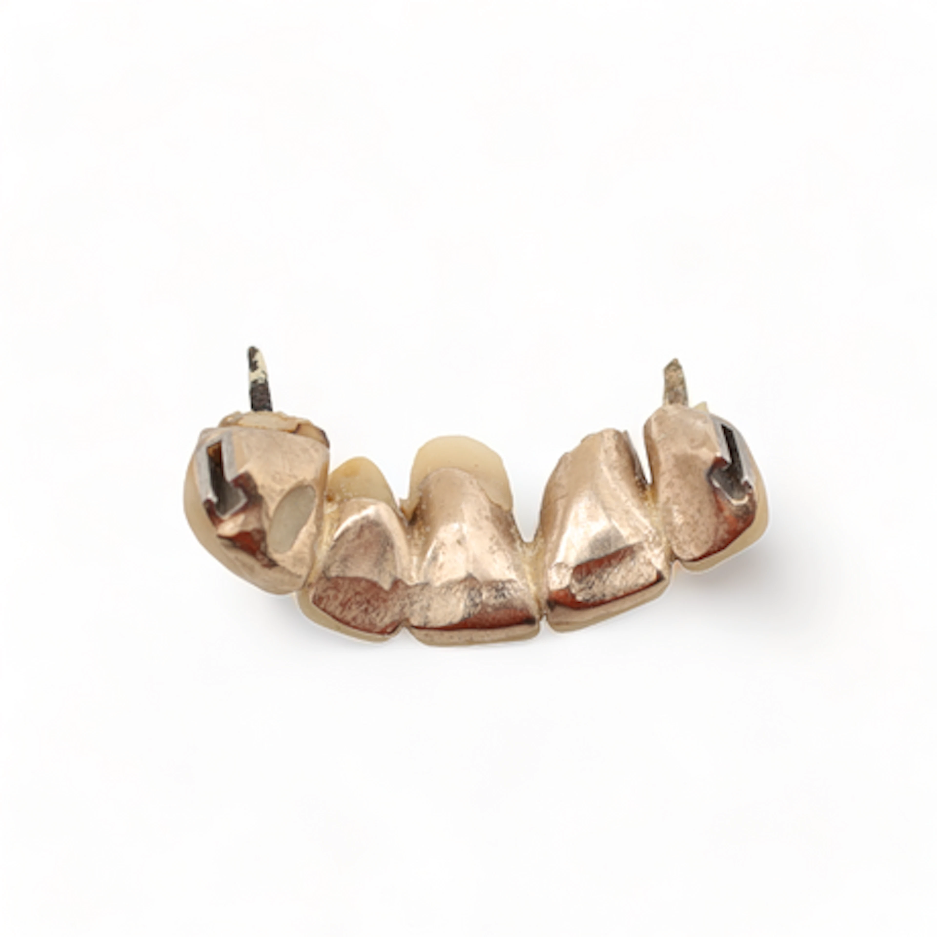 TANDGULD, orensat, vikt 10,73 gram.